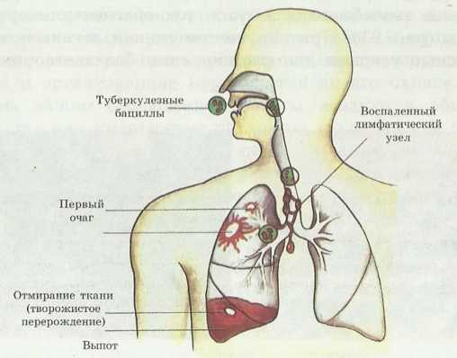 Болезни органов дыхания или гигиена органов дыхания thumbnail